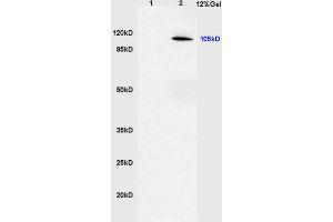 Lane 1: rat brain lysates Lane 2: human gastric carcinoma lysates probed with Anti phospho-CYLD(Ser418) Polyclonal Antibody, Unconjugated (ABIN683833) at 1:200 in 4 °C. (CYLD 抗体  (pSer418))