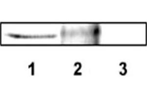 Western blot analysis of DLX4 using DLX4 polyclonal antibody . (DLX4 抗体  (AA 1-60))