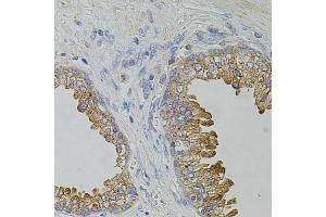 Immunohistochemistry of paraffin-embedded human prostate using TRPA1 antibody. (TRPA1 抗体)