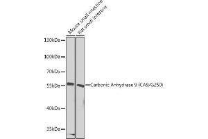 Western blot analysis of extracts of various cell lines, using Carbonic Anhydrase 9 (C/G250) Antibody (ABIN6131266, ABIN6137798, ABIN6137800 and ABIN6217767) at 1:1000 dilution. (CA9 抗体  (AA 52-151))