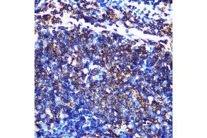 Immunohistochemistry of paraffin-embedded mouse spleen using HLA-DQ Rabbit mAb (1252) at dilution of 1:100 (40x lens). (HLA-DQA1 抗体)