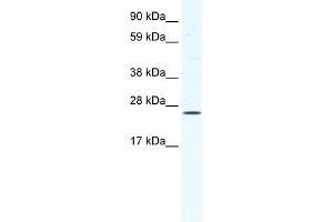 Western Blotting (WB) image for anti-BRF1, RNA polymerase III transcription initiation factor subunit (BRF1) (C-Term) antibody (ABIN2780068)