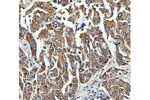 IHC analysis of FRY using anti-FRY antibody (ABIN7599716).