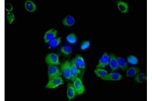 Immunofluorescent analysis of A549 cells using ABIN7170231 at dilution of 1:100 and Alexa Fluor 488-congugated AffiniPure Goat Anti-Rabbit IgG(H+L) (SLC35F2 抗体  (AA 335-374))