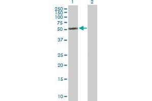 Western Blot analysis of CYP2R1 expression in transfected 293T cell line by CYP2R1 MaxPab polyclonal antibody. (CYP2R1 抗体  (AA 1-501))