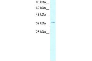 WB Suggested Anti-HOXD12 Antibody Titration:  5. (HOXD12 抗体  (N-Term))