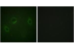 Immunofluorescence analysis of HeLa cells, using MARK1/2/3/4 (Ab-215) Antibody. (MARK1/2/3/4 抗体  (AA 181-230))