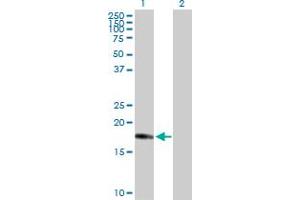 Western Blot analysis of CENPM expression in transfected 293T cell line by CENPM MaxPab polyclonal antibody. (CENPM 抗体  (AA 1-180))