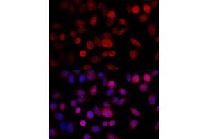Immunofluorescence (IF) image for anti-Cytochrome P450, Family 1, Subfamily B, Polypeptide 1 (CYP1B1) (AA 1-260) antibody (ABIN3021931)