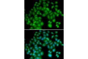 Immunofluorescence analysis of HeLa cells using TMSB4X antibody (ABIN3213357). (TMSB4X 抗体)