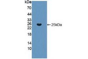 Detection of Recombinant KRAS, Human using Polyclonal Antibody to V-Ki-Ras2 Kirsten Rat Sarcoma Viral Oncogene Homolog (KRAS) (K-RAS 抗体  (AA 1-189))
