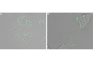 Expression of CXCR5 in human LNCaP cells - Cell surface detection of CXCR5 in intact living human prostate carcinoma (LNCaP) cells. (CXCR5 抗体  (Extracellular))