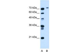 WB Suggested Anti-BCHE Antibody Titration:  1. (Butyrylcholinesterase 抗体  (N-Term))