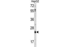 Western blot analysis of TIMP3 Antibody (Center) in HepG2 cell line lysates (35 µg/lane). (TIMP3 抗体  (Middle Region))
