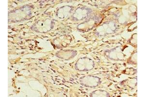 Immunohistochemistry of paraffin-embedded human small intestine tissue using ABIN7150796 at dilution of 1:100 (DYRK4 抗体  (AA 201-520))
