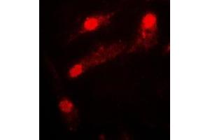 Immunofluorescent analysis of LIMK2 staining in COLO205 cells. (LIMK2 抗体  (Center))