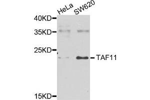 Western blot analysis of extracts of various cells, using TAF11 antibody. (TAF11 抗体)