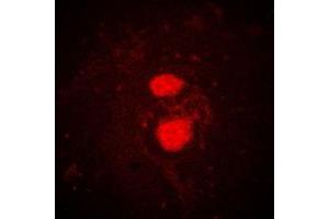 Immunofluorescent analysis of FRK staining in K562 cells. (FRK 抗体  (Center))