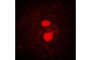 Immunofluorescent analysis of FRK staining in K562 cells. (FRK 抗体  (Center))