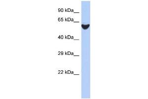 Western Blotting (WB) image for anti-BRF2, Subunit of RNA Polymerase III Transcription Initiation Factor, BRF1-Like (BRF2) (N-Term) antibody (ABIN2784260)