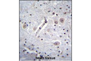 RK Antibody (C-term) (ABIN652301 and ABIN2841363) immunohistochemistry analysis in forlin fixed and paraffin embedded hun brain tissue followed by peroxidase conjugation of the secondary antibody and DAB staining. (MARK1 抗体  (C-Term))