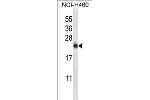 IL13 Antibody (C-term) (ABIN657659 and ABIN2846653) western blot analysis in NCI- cell line lysates (35 μg/lane).