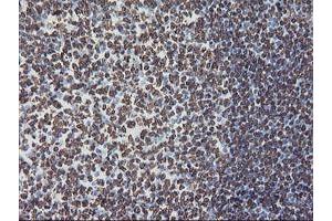 Image no. 13 for anti-F-Box Protein 21 (FBXO21) antibody (ABIN1498233) (FBXO21 抗体)