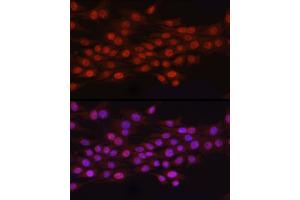 Immunofluorescence analysis of PC-12 cells using N6 Rabbit pAb (ABIN6131779, ABIN6144314, ABIN6144315 and ABIN6223027) at dilution of 1:100 (40x lens). (N6AMT1 抗体  (AA 1-186))