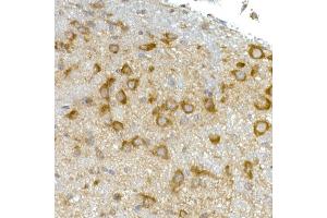 Immunohistochemistry of paraffin-embedded mouse brain using RPL13 Rabbit mAb (ABIN7269993) at dilution of 1:50 (40x lens). (RPL13 抗体)