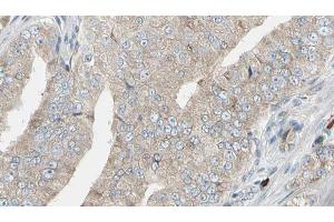 ABIN6272945 at 1/100 staining Human prostate tissue by IHC-P. (LDHB 抗体  (N-Term))