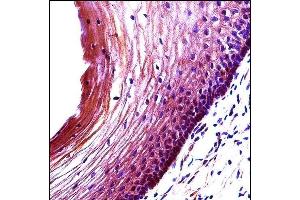 BBC3 Antibody (Center) (ABIN658021 and ABIN2850502) immunohistochemistry analysis in formalin fixed and paraffin embedded human cervix tissue followed by peroxidase conjugation of the secondary antibody and DAB staining. (PUMA 抗体  (AA 109-137))