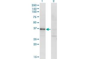 Western Blot analysis of RBKS expression in transfected 293T cell line by RBKS monoclonal antibody (M01), clone 3B4. (Ribokinase 抗体  (AA 1-322))