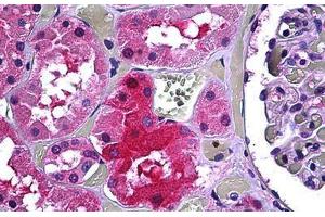 Human Kidney, Tubules: Formalin-Fixed, Paraffin-Embedded (FFPE) (GALT 抗体  (AA 1-380))