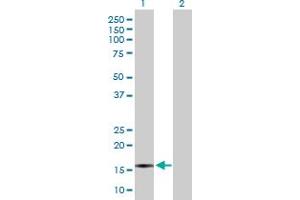 Western Blot analysis of CXCL5 expression in transfected 293T cell line by CXCL5 MaxPab polyclonal antibody. (CXCL5 抗体  (AA 1-114))