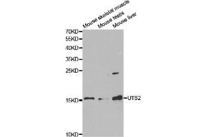 Western blot analysis of extracts of various cell lines, using UTS2 antibody. (Urotensin 2 抗体)