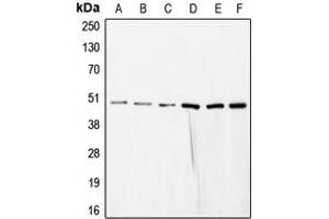 Western blot analysis of COPS3 expression in HeLa (A), SP2/0 (B), mouse liver (C), rat liver (D), NIH3T3 (E), HEK293T (F) whole cell lysates. (COPS3 抗体  (Center))