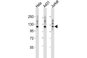 All lanes : Anti-ITGA7 Antibody (N-term) at 1:2000 dilution Lane 1: Hela whole cell lysates Lane 2: A431 whole cell lysates Lane 3: Jurkat whole cell lysates Lysates/proteins at 20 μg per lane. (ITGA7 抗体  (N-Term))