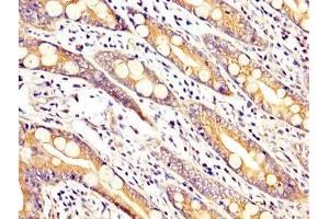 IHC image of ABIN7167935 diluted at 1:200 and staining in paraffin-embedded human small intestine tissue performed on a Leica BondTM system. (ARHGAP18 抗体  (AA 389-577))