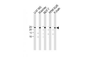 All lanes : Anti-C9orf95 Antibody (N-term) at 1:1000 dilution Lane 1: U-87 MG whole cell lysate Lane 2: M. (NMRK1 抗体  (N-Term))