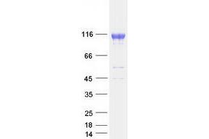 Western Blotting (WB) image for ATP-Binding Cassette, Sub-Family G (WHITE), Member 1 (ABCG1) (Transcript Variant 2) protein (Myc-DYKDDDDK Tag) (ABIN2714269)