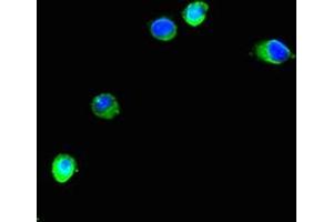 Immunofluorescent analysis of Hela cells using ABIN7151266 at dilution of 1:100 and Alexa Fluor 488-congugated AffiniPure Goat Anti-Rabbit IgG(H+L) (TRIM37 抗体  (AA 301-600))
