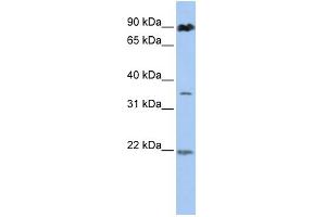 WB Suggested Anti-C13orf7 Antibody Titration:  0. (RNF219 抗体  (N-Term))