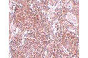 Immunohistochemistry of TSPAN9 in human spleen tissue with this product at 2. (Tetraspanin 9 抗体  (Center))
