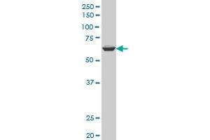 Western Blotting (WB) image for anti-Apoptosis Antagonizing Transcription Factor (AATF) (AA 151-250) antibody (ABIN565284)