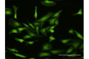 Immunofluorescence of purified MaxPab antibody to NLRP2 on HeLa cell. (NLRP2 抗体  (AA 1-1062))