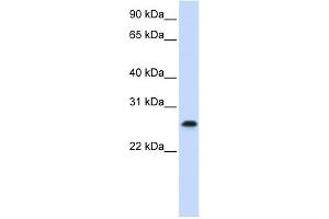 WB Suggested Anti-PHF19 Antibody Titration:  0. (PHF19 抗体  (C-Term))