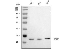 Western blot analysis of PNP using anti-PNP antibody (ABIN4886701).