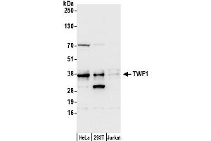 Western Blotting (WB) image for anti-Twinfilin, Actin-Binding Protein 1 (TWF1) (AA 1-50) antibody (ABIN7453235)