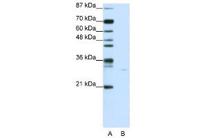 SGK1 antibody used at 1 ug/ml to detect target protein. (SGK1 抗体  (N-Term))