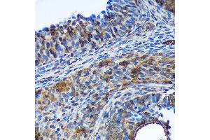 Immunohistochemistry of paraffin-embedded Rat ovary using TSN Rabbit pAb  at dilution of 1:100 (40x lens). (Translin 抗体  (AA 50-150))